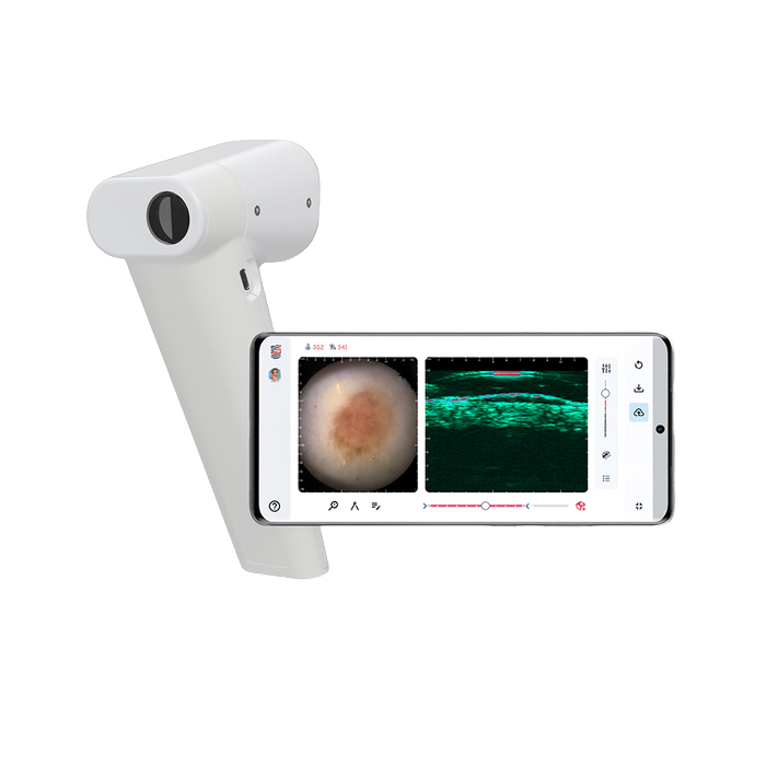 SkinScanner